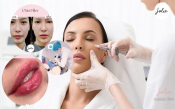 How long will Filler injections last?